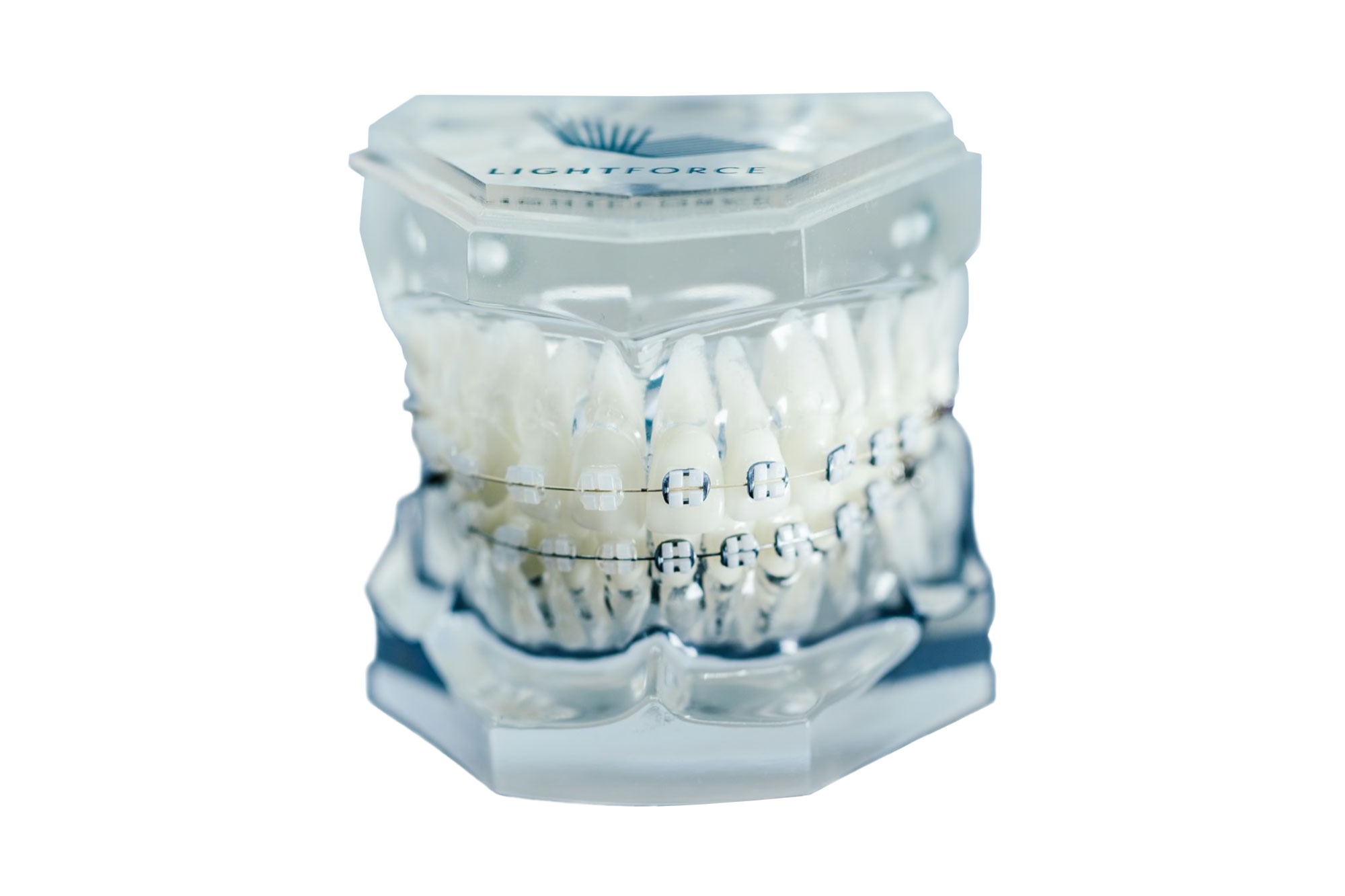 new-york-braces-002 new york braces