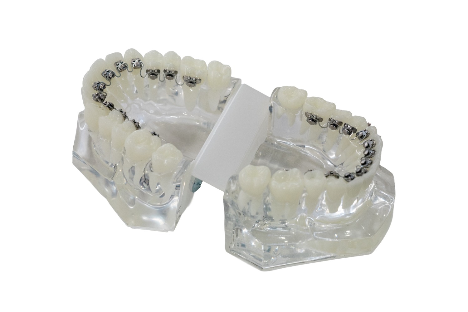 insmile-lingual-braces-v2 insmile-lingual-braces-v2
